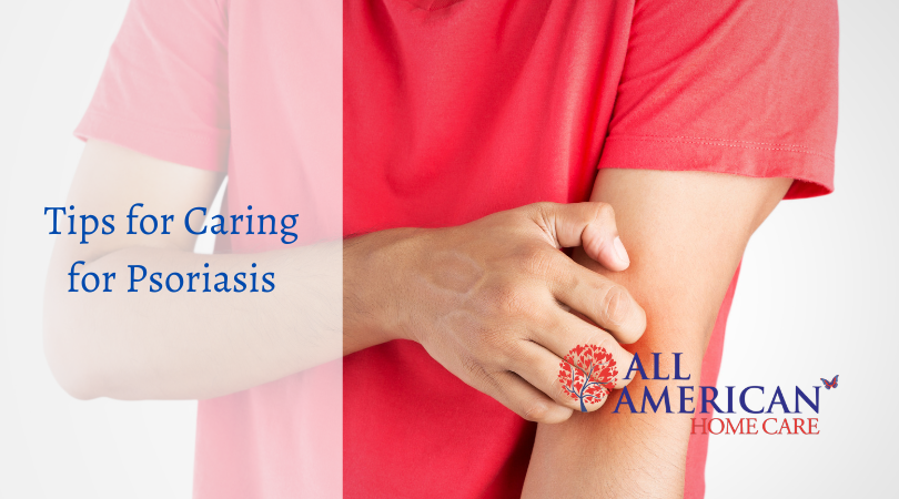 Tips for Caring for Psoriasis Patients