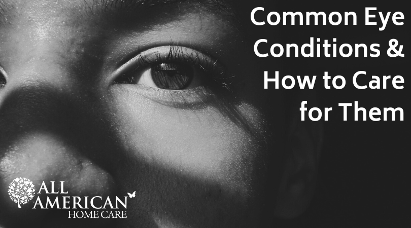 Common Eye Conditions and How to Care for Them